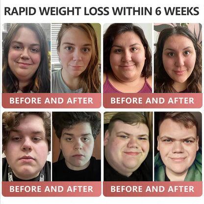 Patches🎉 - Slimming, Skin Tightening, Blood Sugar Support, No Injection, 7- Day Result