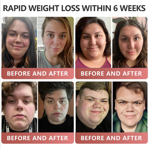 Patches🎉 - Slimming, Skin Tightening, Blood Sugar Support, No Injection, 7- Day Result